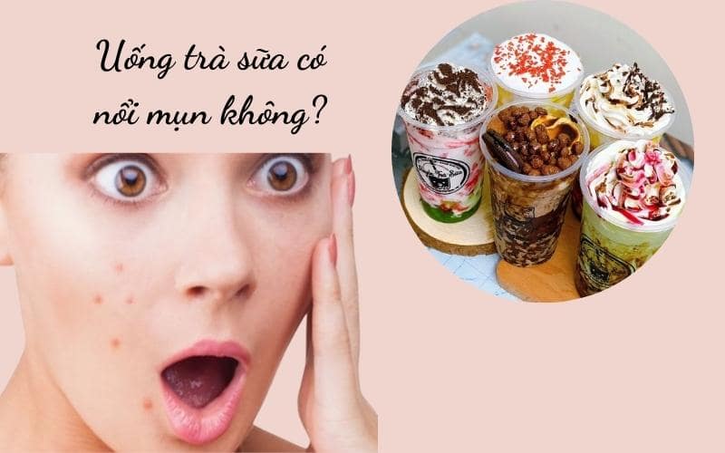 uống trà sữa có nổi mụn không uống trà sữa có nổi mụn không